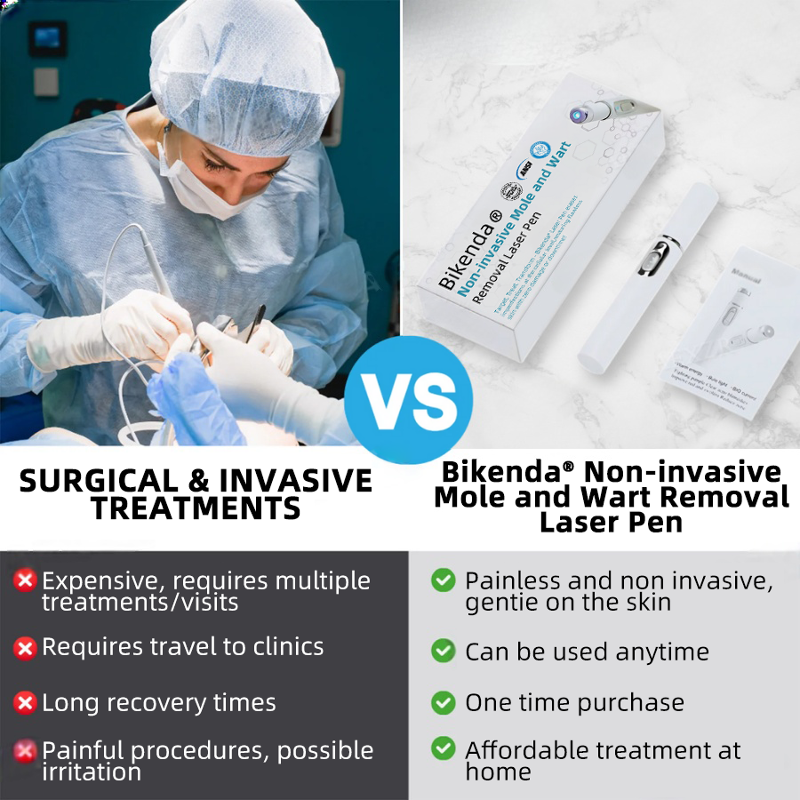 Non-Invasive Mole and Wart Removal Laser Pen Promax