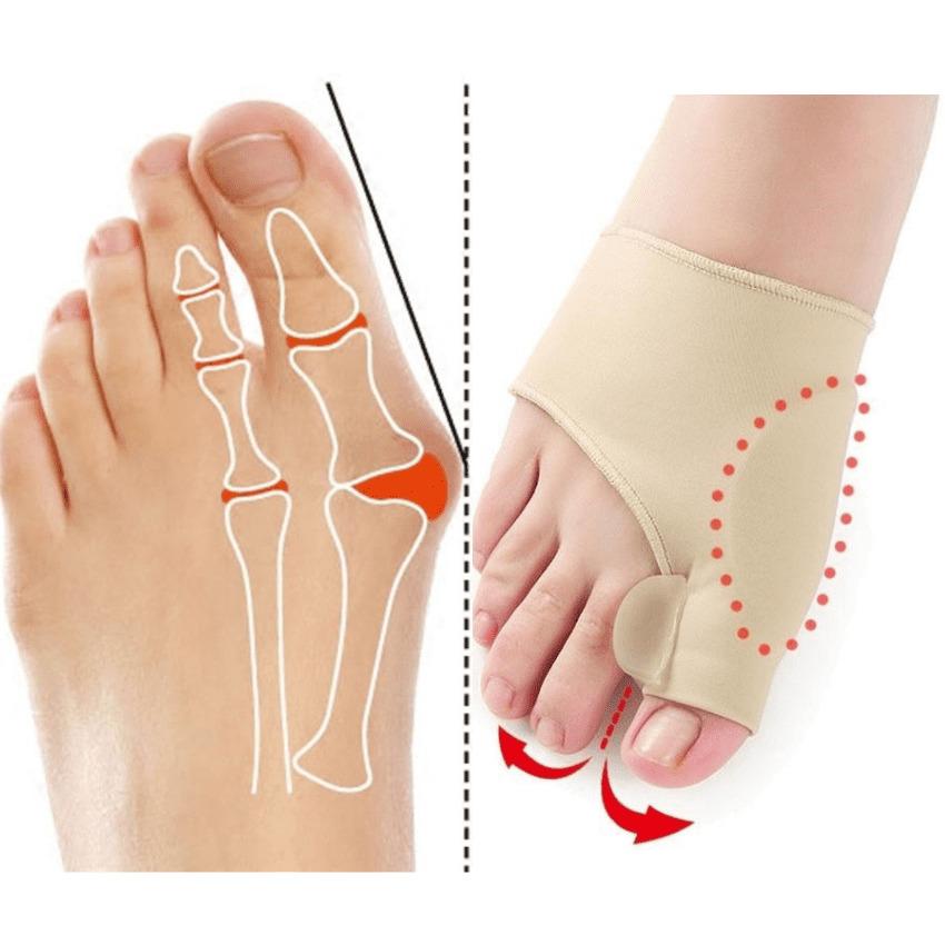 Original Orthopedic Bunion Corrector - Correctionmax™